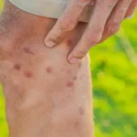 porqué las moscas son molestas