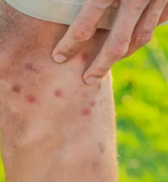 ¿Porqué las moscas son tas molestas? 2 porqué las moscas son molestas