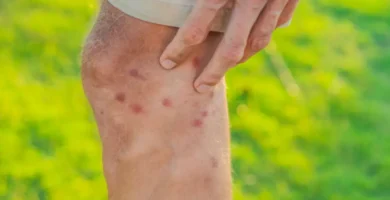 porqué las moscas son molestas