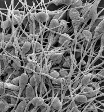 Micrografia electronica de barrido de espermatozoides humanos